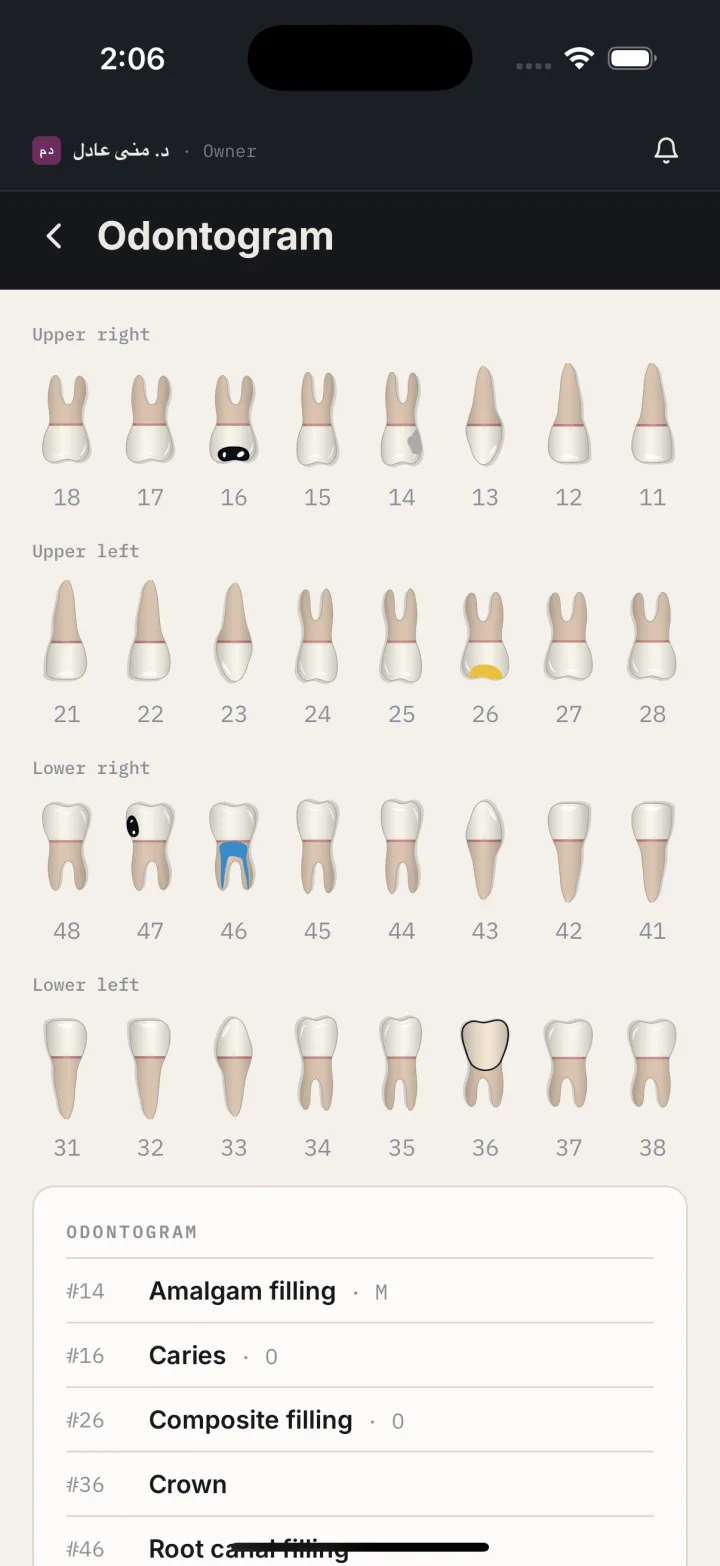 App screenshot: full-screen tooth chart